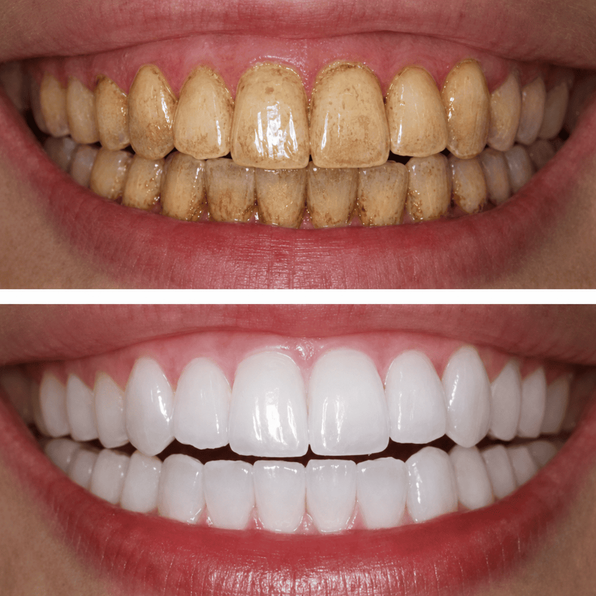 V34 Purple Teeth Colour Corrector Serum