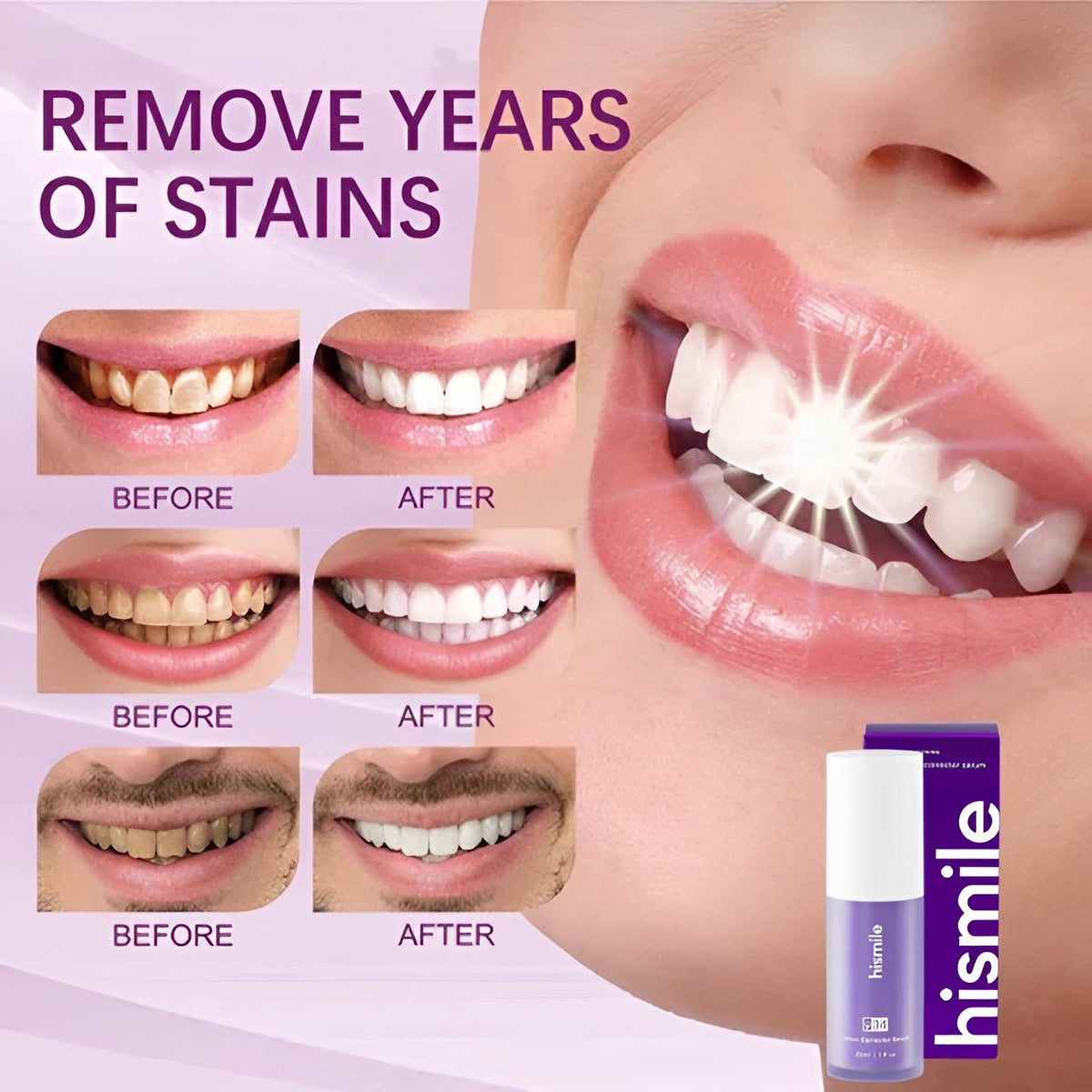 V34 Purple Teeth Colour Corrector Serum